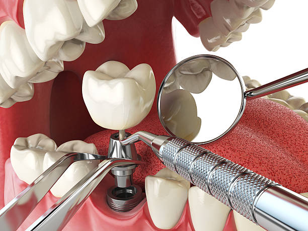 Best Root Canal Emergency Dentist  in Eastpointe, MI
